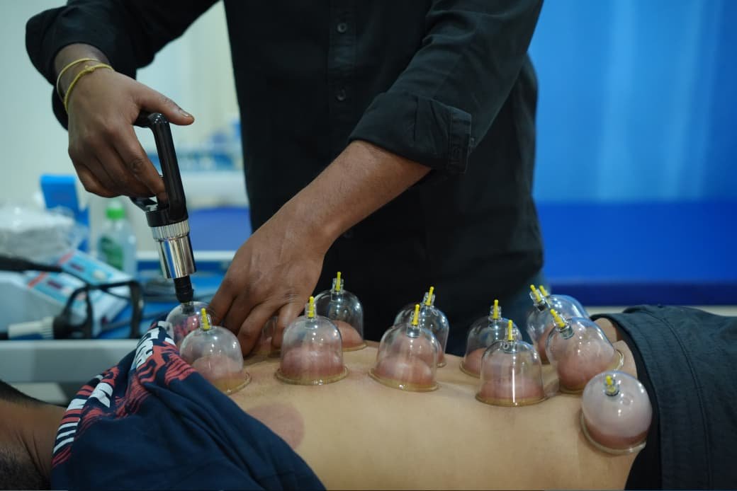 Close-up of cupping therapy treatment on patient back