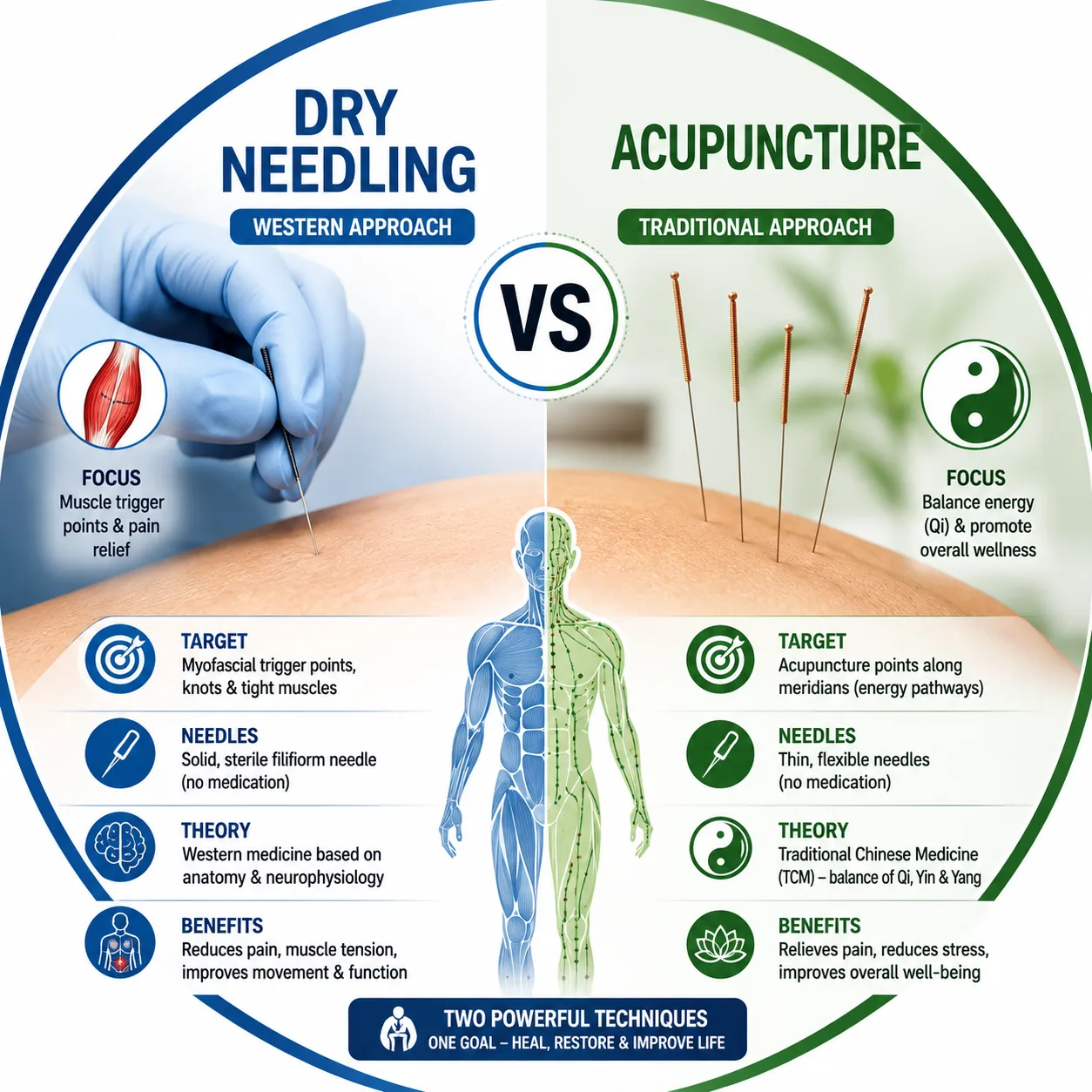 Dry Needling vs Acupuncture: What's the Difference?